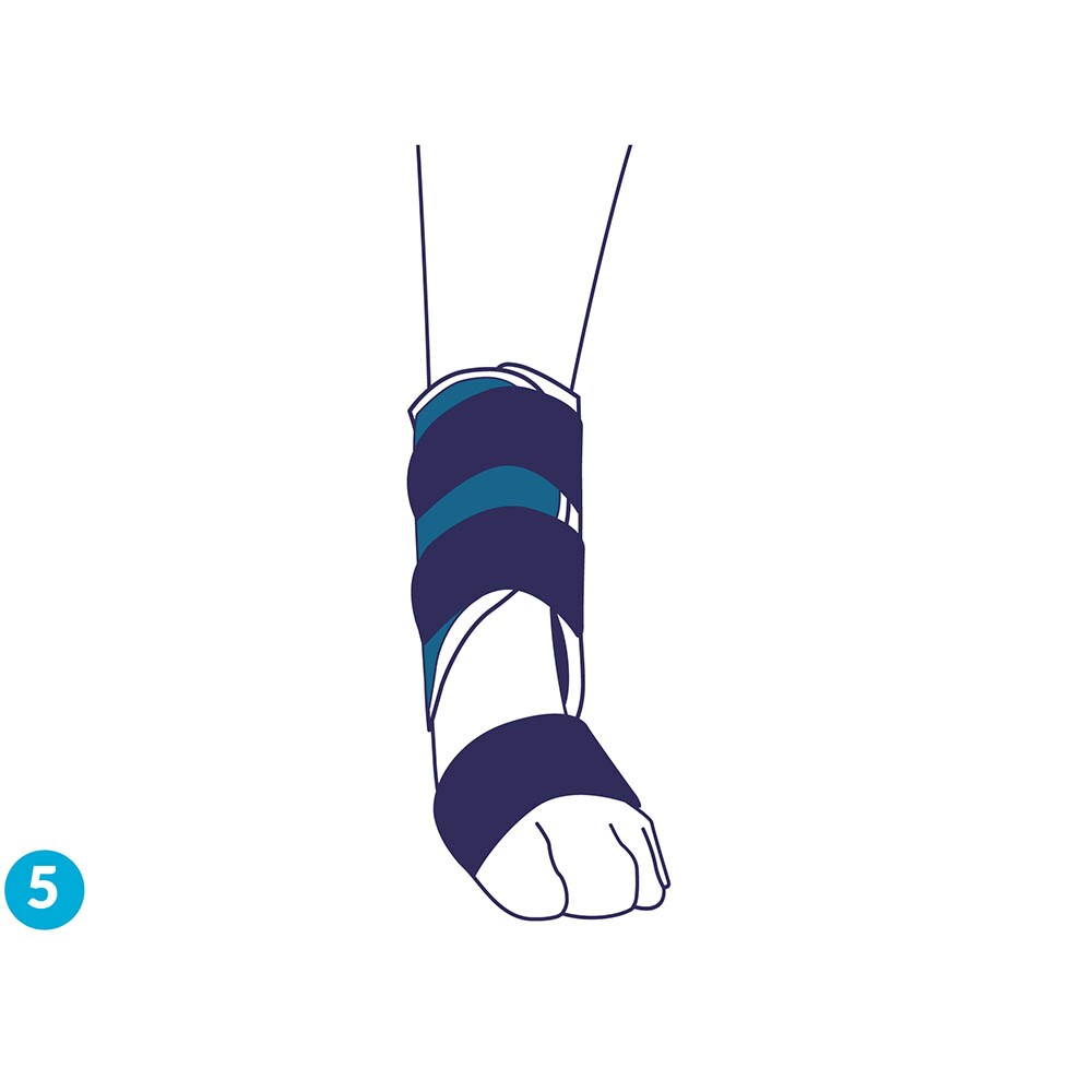 Balto Rehab-Orthese BT Splint _7